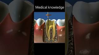 Root canal treatment #rootcanalspecialist #teeth #medical