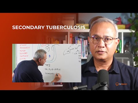 Secondary Tuberculosis