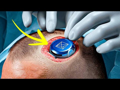 NEURALINK Second Human Trials! Elon Musk Reveals NEW Updates