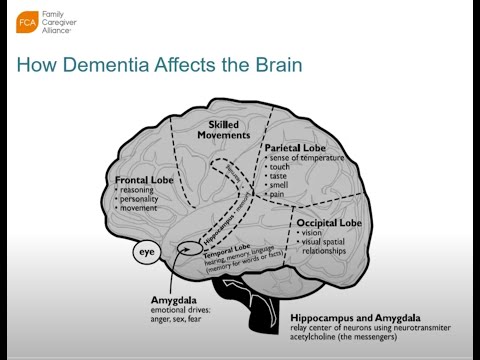 2023-1014 Communication Challenges for Dementia and Psychosis - Christina Irving, LCSW