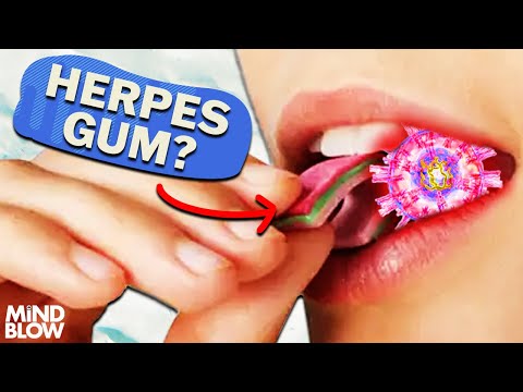 Herpes Gum? - Mind Blow #142