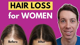 How to Treat Female Hair Loss | Hair Surgeon Advice