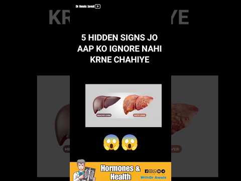 5 Hidden Signs of Fatty Liver You Shouldn’t Ignore! 😱
