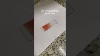 “Tongue shaped smear” 🥴 | Pathology | MBBS 2nd year #medicalstudent #medicalcollege #mbbs #ytshorts