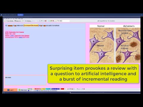Boosting cloze review with notes from artificial intelligence (incremental reading on Alzheimer's)