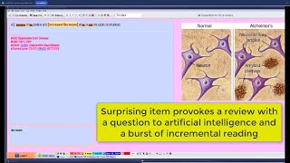 Boosting cloze review with notes from artificial intelligence (incremental reading on Alzheimer's)