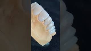 #dental #dentalclinic #orthodontist #dentalworld #dentallaboratory #teethwhitening #dentalwork
