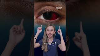 Is your eye bleeding? Don’t panic just yet. 😳