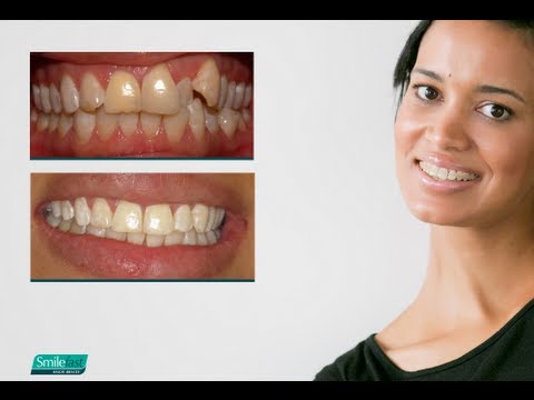 What Are Magic Braces? - Advanced Orthodontics TV ad