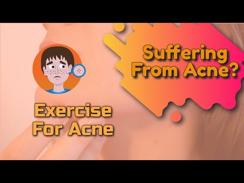 Exercise For Acne
