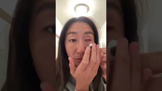 The struggle of having a prosthetic eye… #prostheticeye #eyecancer #cancersurvivor #eyes