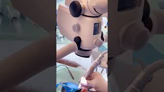 Root Canal Treatment by Dr. Wael Arabi #rootcanalspecialist #rootcanaldubai