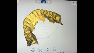 Digital impression making