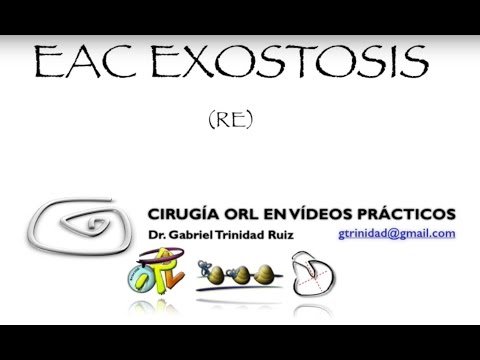 OCCLUSIVE EAC EXOSTOSIS. ENDAURAL APPROACH