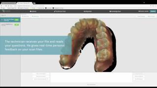 Condor intra oral scanner - Video 5
