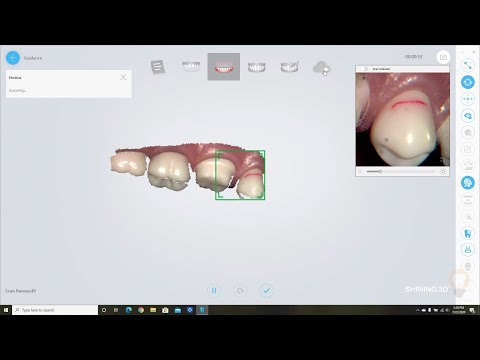 My First Digital Impression - Complete