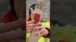First Aid on an Abrasion 🩸🚑 #ambulance #paramedic #firstaid #emergency #hospital #nurse //Ad