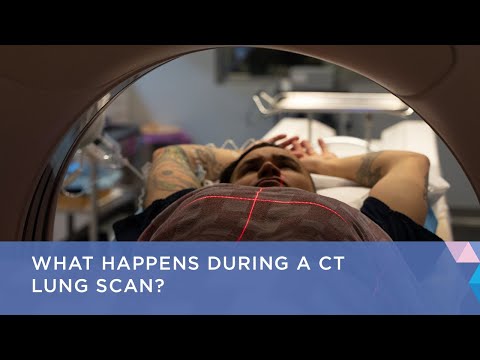 What Happens During a CT Lung Scan?