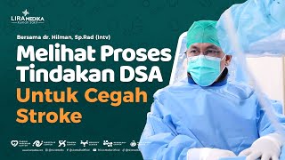 Simple - This is the Process of Stroke Prevention with Digital Subtraction Angiography (DSA)