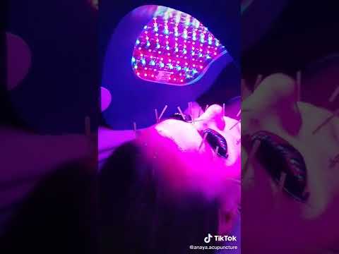 Acupuncture Facial with Celluma Light Therapy -  skin rejuvenation, reduction of wrinkles