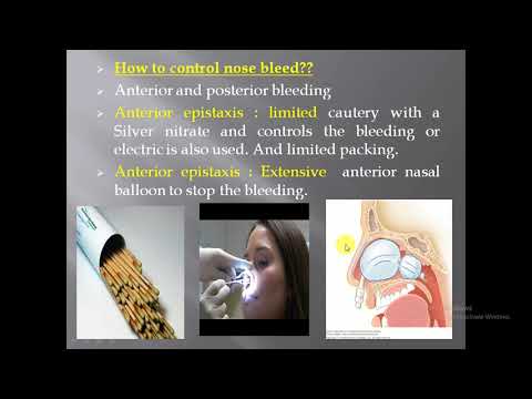 Medical Coding | Epistaxis Surgery Coding in ED  |  Emergency Department