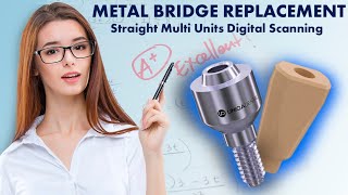 Screw Retained restoration on Straight Multi Units Digital Scanning Metal bridge replacement