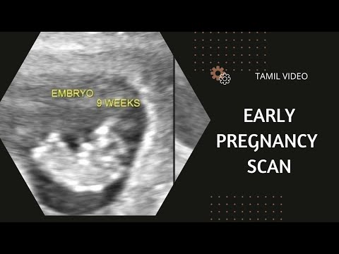 Eary pregnancy scan ( Tamil )