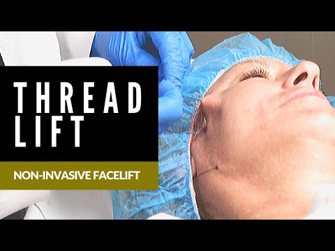 Non-Invasive Facelift | Thread Lift | Young Medical Spa