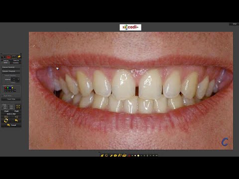 How to use the Whitening Simulator in CADI