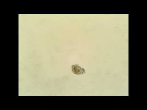 Rotifer Locomotion Video