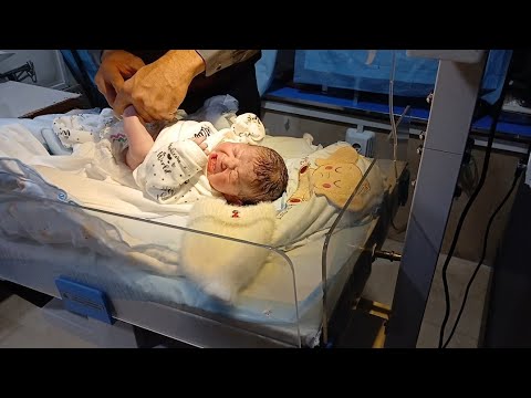 Newborn Baby Initial Assessment | Checking RBS (Random Blood Sugar) 👶🩺