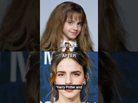 Emma Watson’s Jaw-Dropping Transformation! 🌟