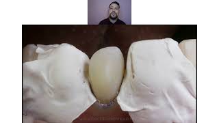 Free Webinar - Injectable Technique/ Flow Injection technique/ Injection molding technique