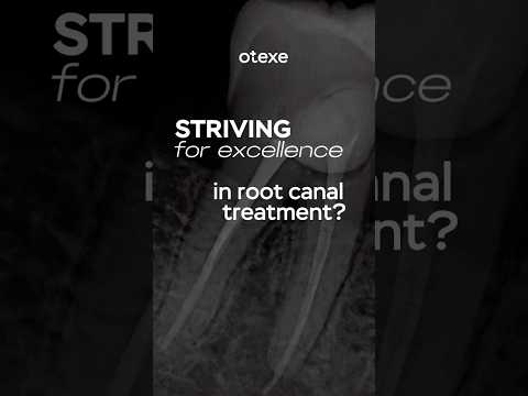 Comment the word “ENDO” to get a guide 👇🏻#endodontics #rootcanaltreatment