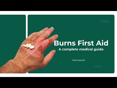 Burns First Aid 