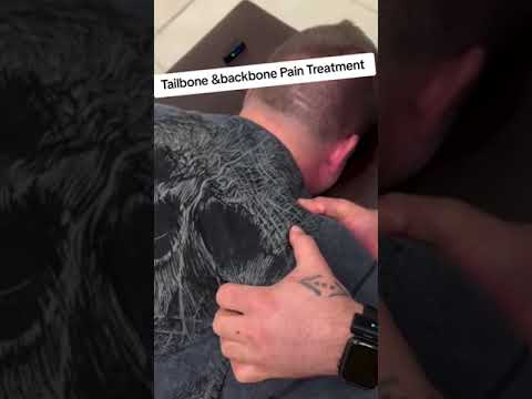 Tailbone & Backbone pain treatment via chiropractic #tailbonepain #tailbonepaintreatment #coccyxpa