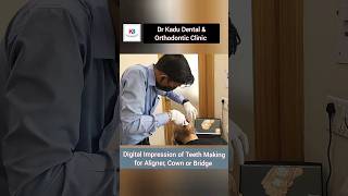 Digital Impression for Dental Treatment|Crown|Bridge #Aligner #ytshorts #trending #ytshorts #viral