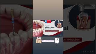 #rootcanal #rct #dentistry #dentist #endodontics #rootcanaltreatment #dental  #rootcanalspecialist