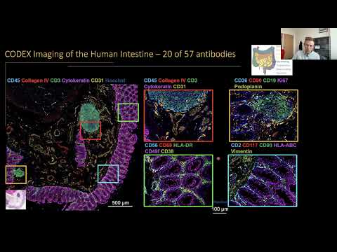 From Molecules to Multicell Modules: Immune-Mediated Tissue Restructuring