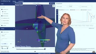 Q&A Mini-Course (D5): "How Cool is That? -- Specialty Data Products for Forecasting Part 5"