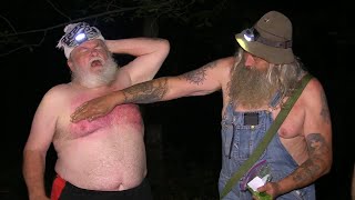 Mountain Monsters Season 8 - Jeff's Sunburn [HD] [2022]