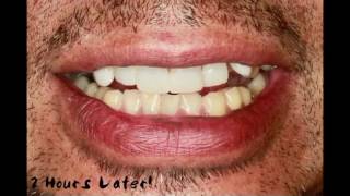 Miguel's 2-Hour Smile Enhancement