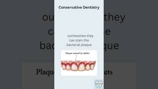 Disclosing agents #disclosingtablets #disclosingtime #plaque #mouthwash #stains #toothbrush #teeth