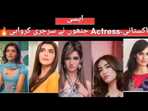 Plastic surgery krwany Wali Actress #socialmedia #viralvideo