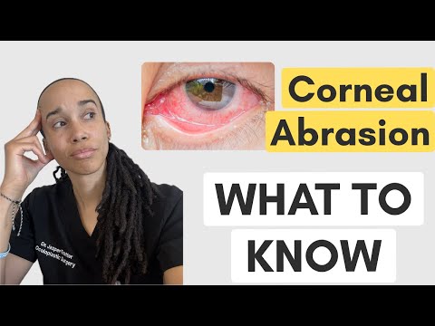 Corneal Abrasion Mini-Course: Treatment, Red Flags, and When to Call Ophthalmology