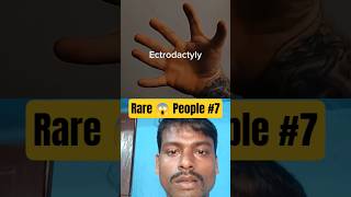 Rare 😱 People part 7 #shorts #facts #knowledge #satisfying #new #rare #health