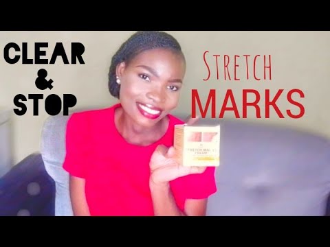Clear all marks with Omega-A Stretch marks cream in 2021#stretchmark #antiaging #antispiderveins