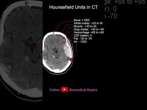 CT Hounsefield  #shorts #biomedicalengineering #radiology