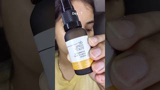 Deconstruct Vitamin C Serum review 7 Days Challenge #shorts #skincare #7dayschallenge