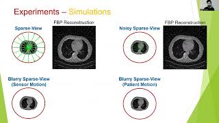 Beyond Local Processing: Adapting CNNs for CT Reconstruction